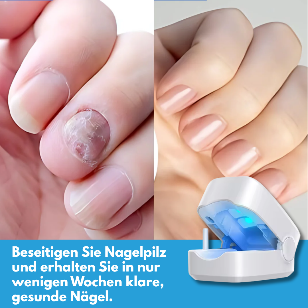 FungaLite Restore™