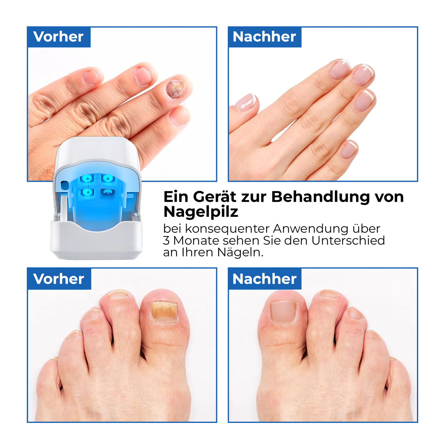 FungaLite Restore™