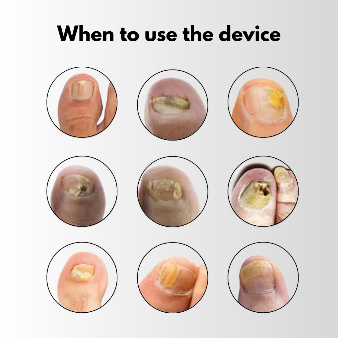 FungaLite Restore™