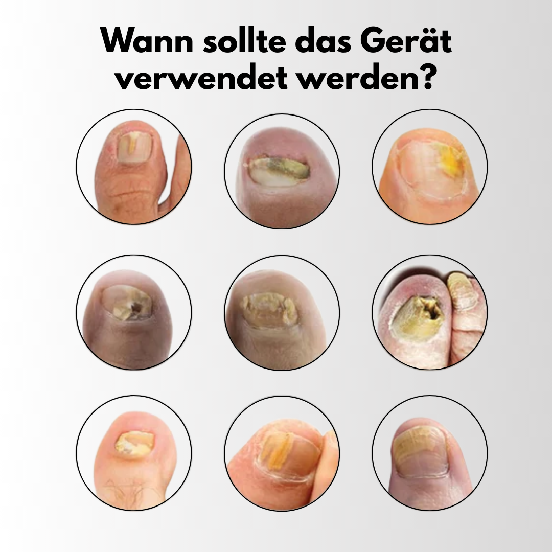 FungaLite Restore™