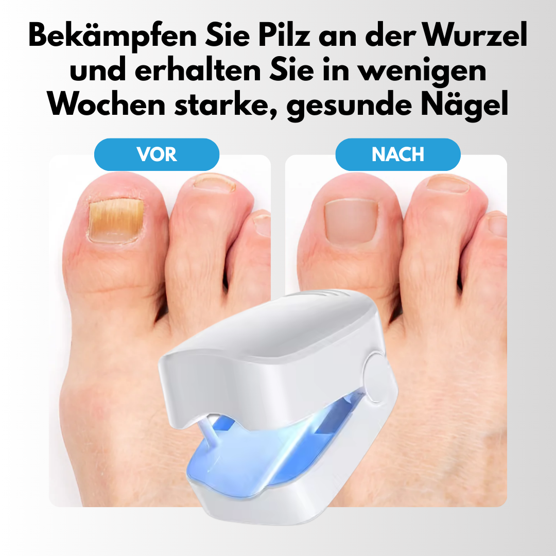 FungaLite Restore™